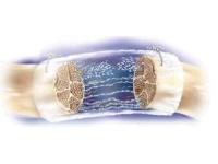 Neuragen nerve guide from Integra LifeSciences